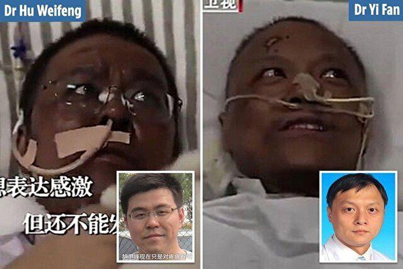 پوست ۲ پزشک چینی مبتلا به کرونا سیاه شد +عکس