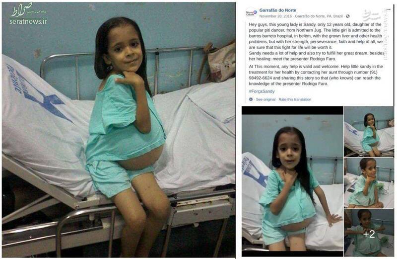 بارداری دختر بچه ۹ ساله در ایران؟! +عکس