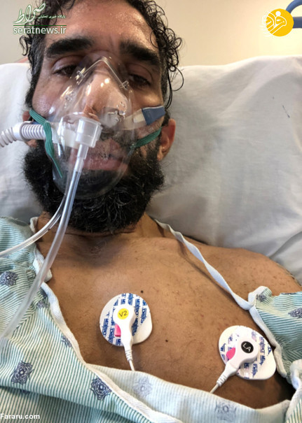 اثرات شوکه کننده کرونا بر بدن یک ورزشکار +تصاویر اثرات شوکه کننده کرونا بر بدن یک ورزشکار +تصاویر