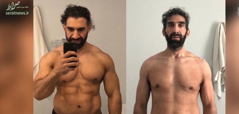 اثرات شوکه کننده کرونا بر بدن یک ورزشکار +تصاویر اثرات شوکه کننده کرونا بر بدن یک ورزشکار +تصاویر