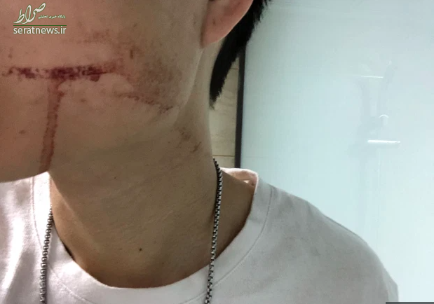 پایان غم انگیز مرد ۲۶ ساله چینی بعد از کشیدن دندان عقل + تصاویر