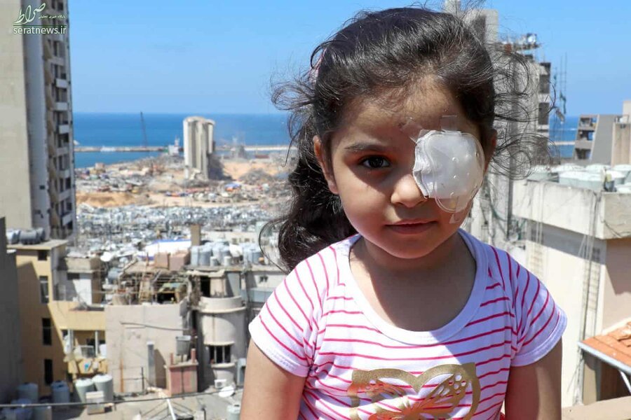 عکس/ دخترک مجروح لبنانی