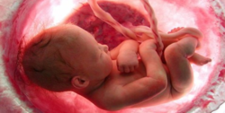 سقط جنین؛ ۱۵ برابر کشته‌های تصادفات جاده‌ای
