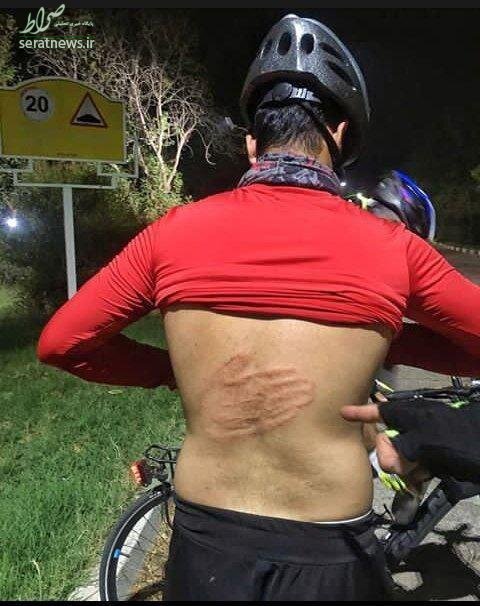 روایتی از آزار و اذیت غیر قابل باور یک دوچرخه‌سوار! + عکس