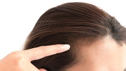 راهکار درمان نازکی و ریزش مو در خانم‌ها