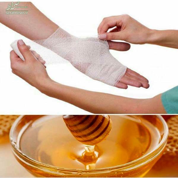 معجزه کرونایی عسل معجزه کرونایی عسل