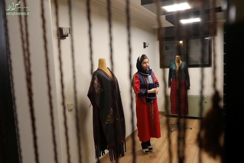 مدلینگ لباس؛ شغل جدید قربانی اسیدپاشی در ایران+عکس