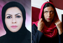 مدلینگ لباس؛ شغل جدید قربانی اسیدپاشی در ایران+عکس