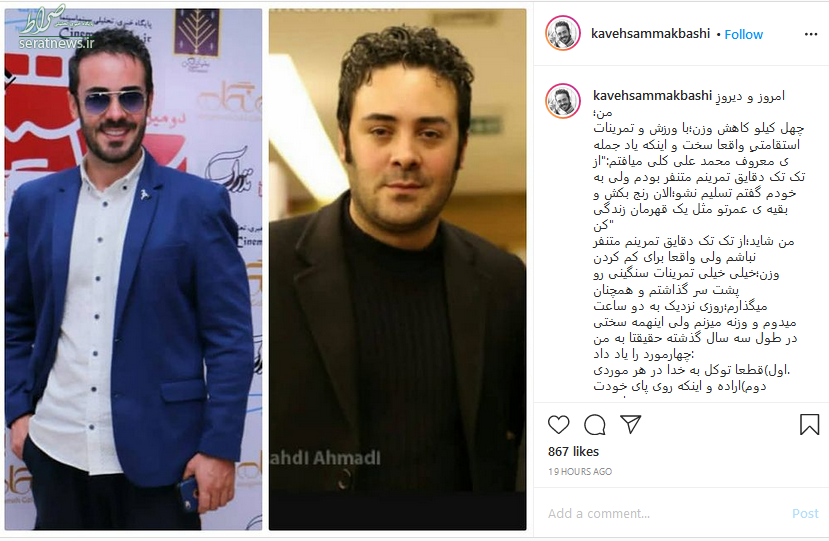 عکس/ کاهش وزن ۴۰ کیلویی بازیگر مشهور ایرانی