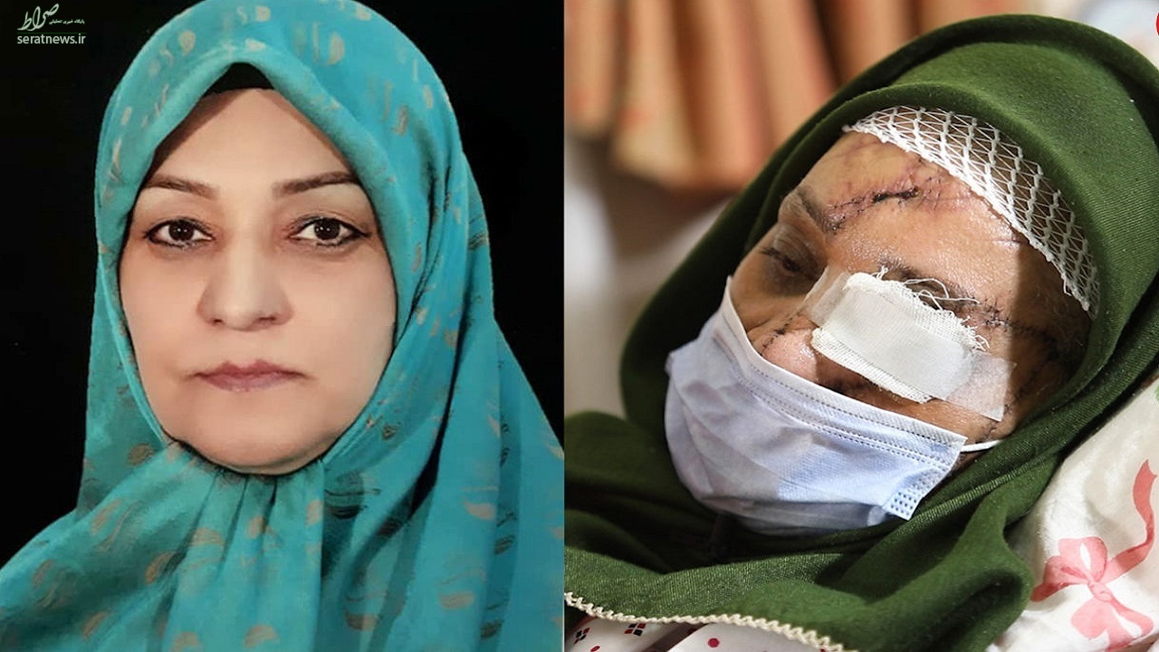 ترسناک‌ترین سرنوشت یک زن ایرانی/ اشرف سادات حسینی تکه تکه شد، اما زنده ماند+ (تصاویر ۱۶+)
