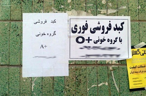 بازار پررونق خرید و فروش کبد در ایران