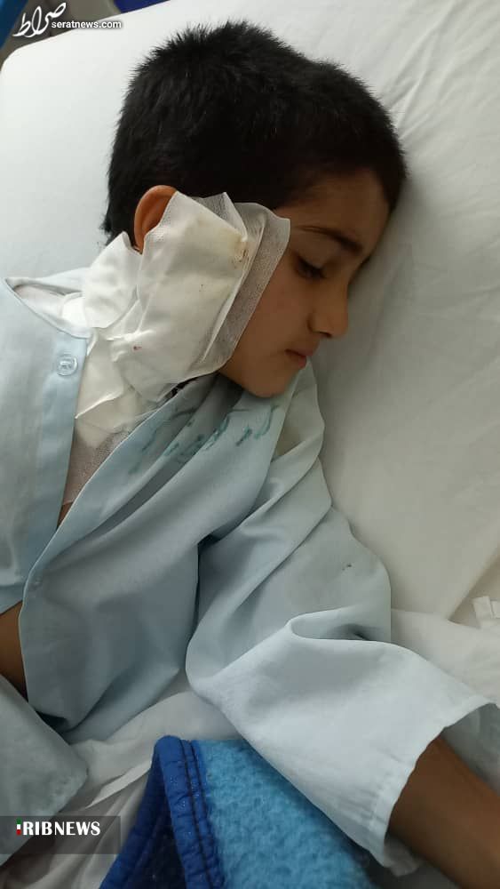 زخمی شدن شدید پسربچه نیشابوری با حمله سگ‌های ولگرد + تصاویر