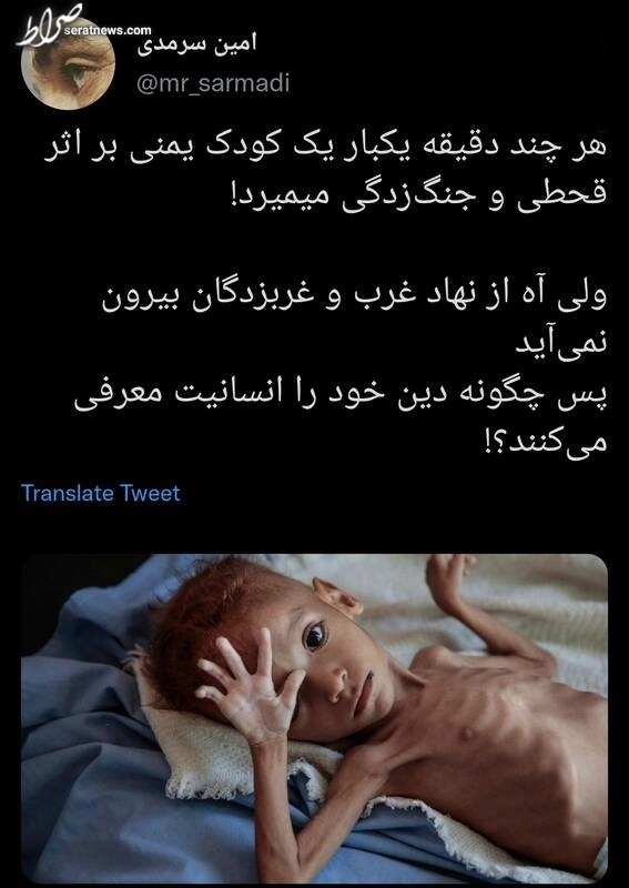 کودکانی که کشته‌ می‌شوند ولی آه از نهاد غرب و غربزدگان بیرون نمی‌آید