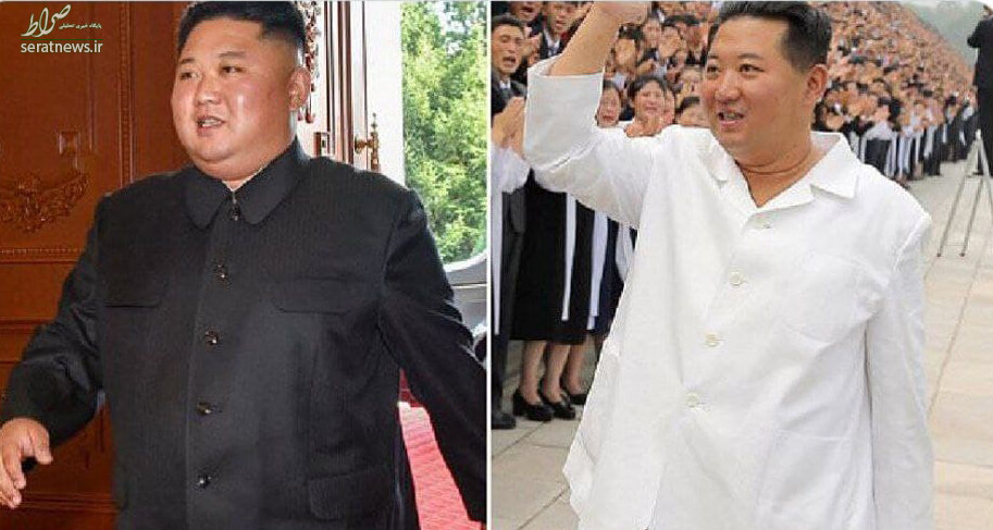 کاهش وزنش شدید رهبر کره شمالی