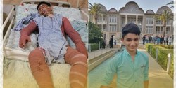 سوختگی عمیق، علت فوت «علی لندی» / جزئیات از قول مسؤولان و پزشک معالج