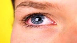 مراقب عوارض چشمی ویروس کرونا باشید