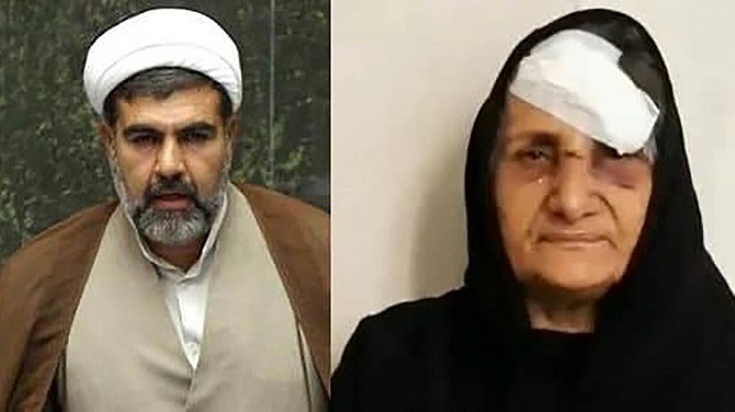 رییس کمیسیون قضایی: دستگاه‌های امنیتی برای شناسایی ضاربان مادر ستار بهشتی اقدام کنند