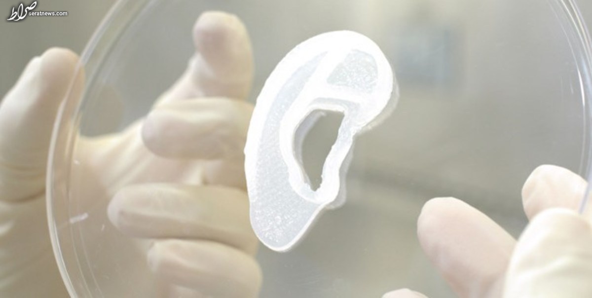 برای اولین بار در جهان: پیوند گوش چاپ سه بعدی به انسان