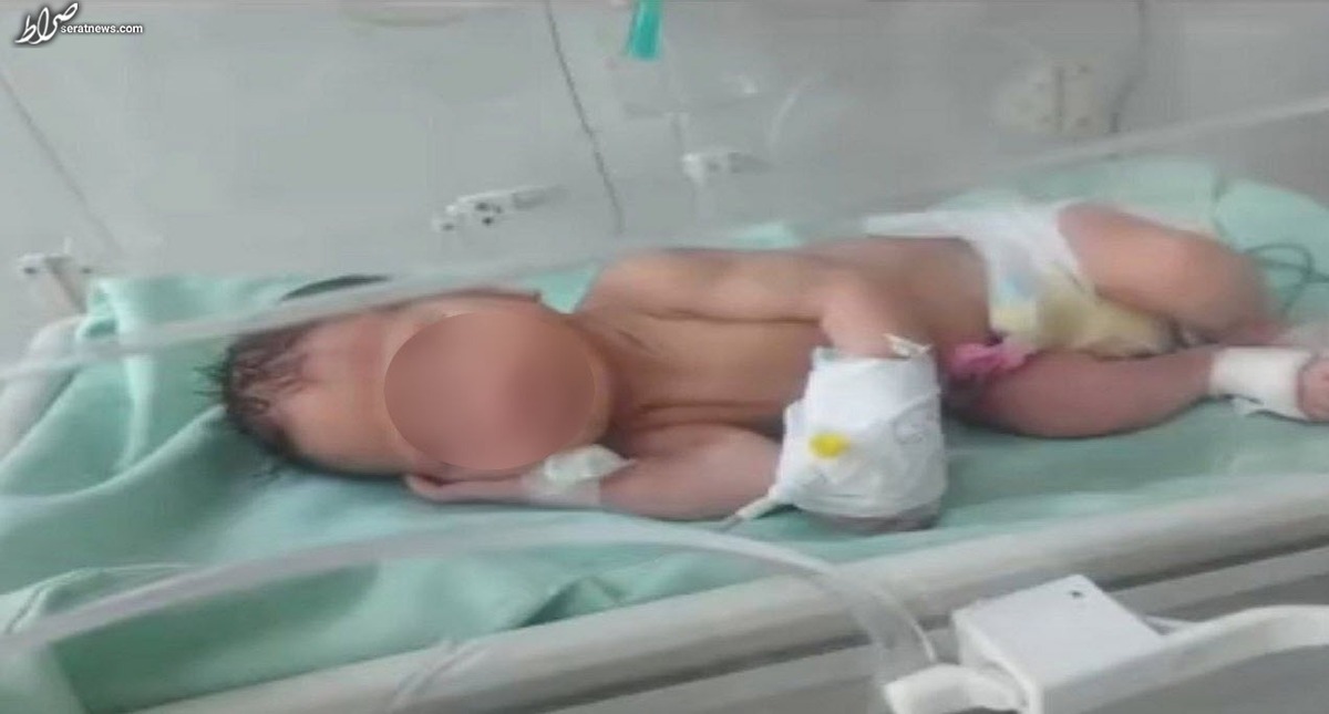 نوزاد زنده در سطل آشغال نازی آباد رها شد