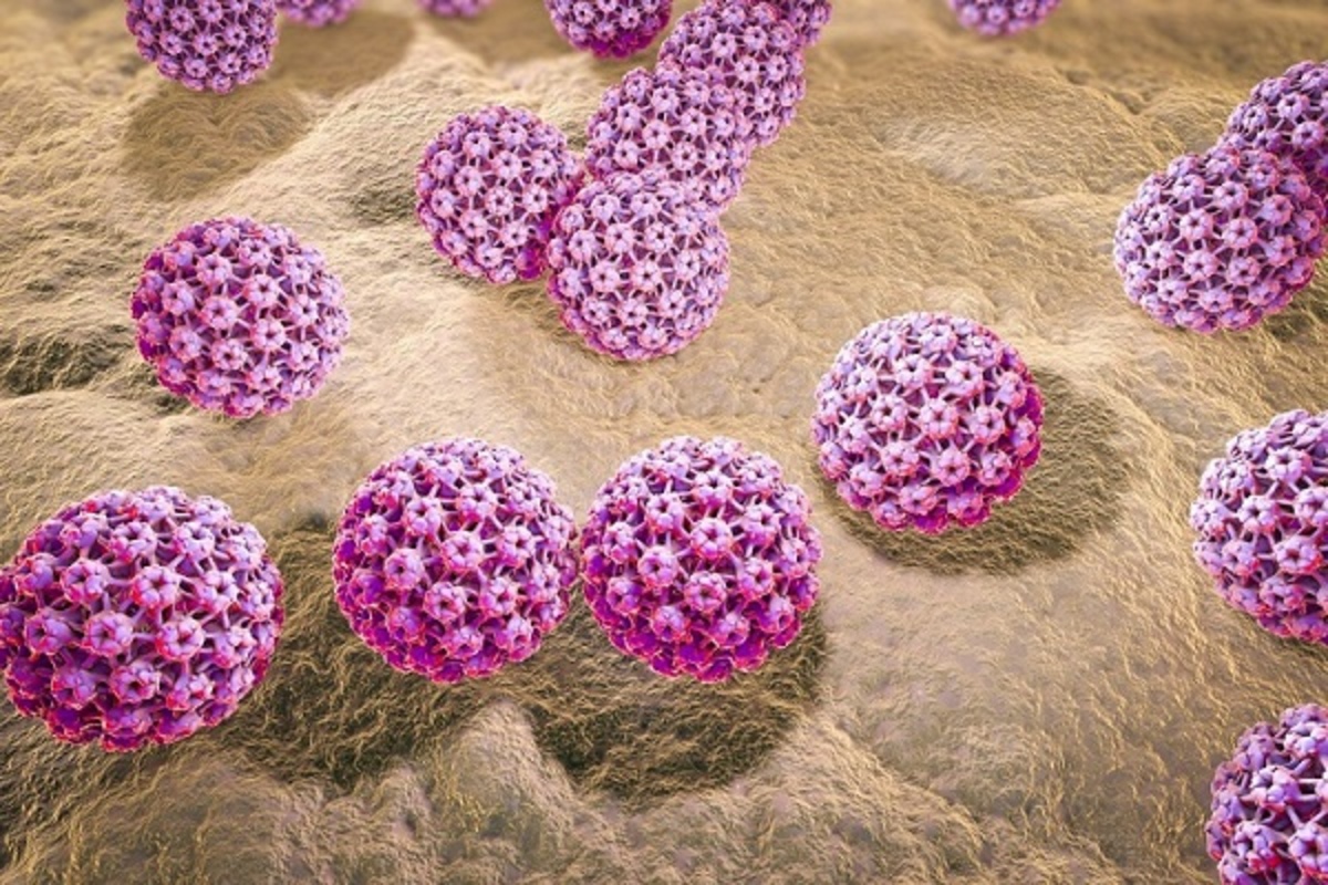 بهترین متخصص زگیل تناسلی برای درمان ویروس HPV کیست؟