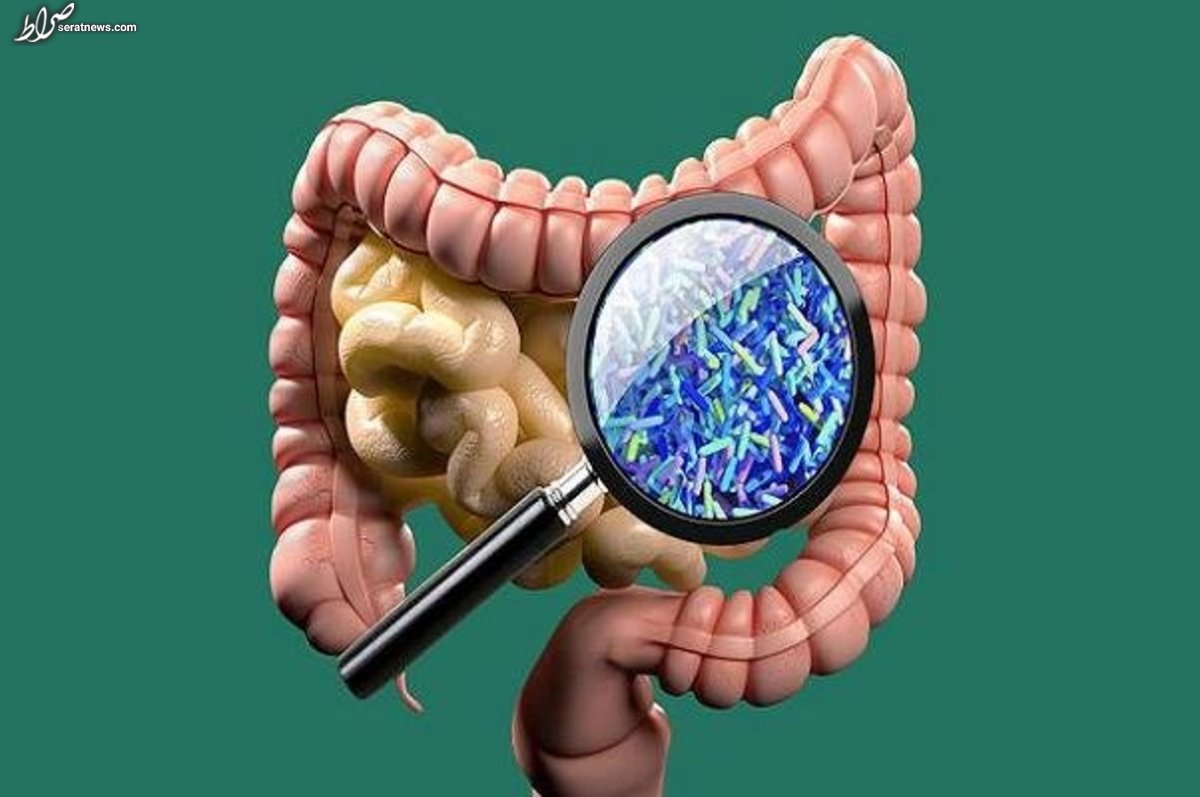 میکروبیومهای روده در بروز عفونت HIV نقش دارند