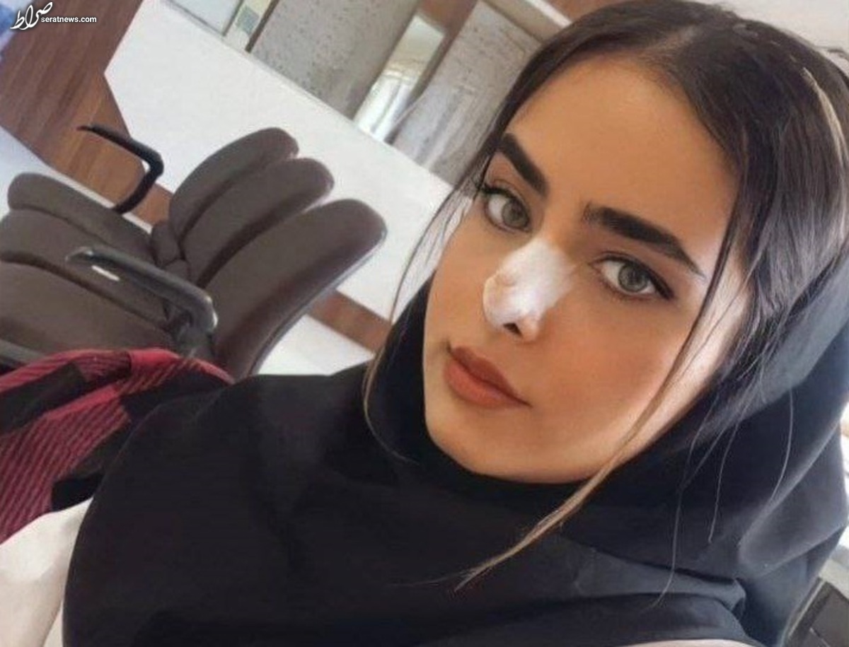 نحوه فوت «آیلار حقی» دختر جوان تبریزی