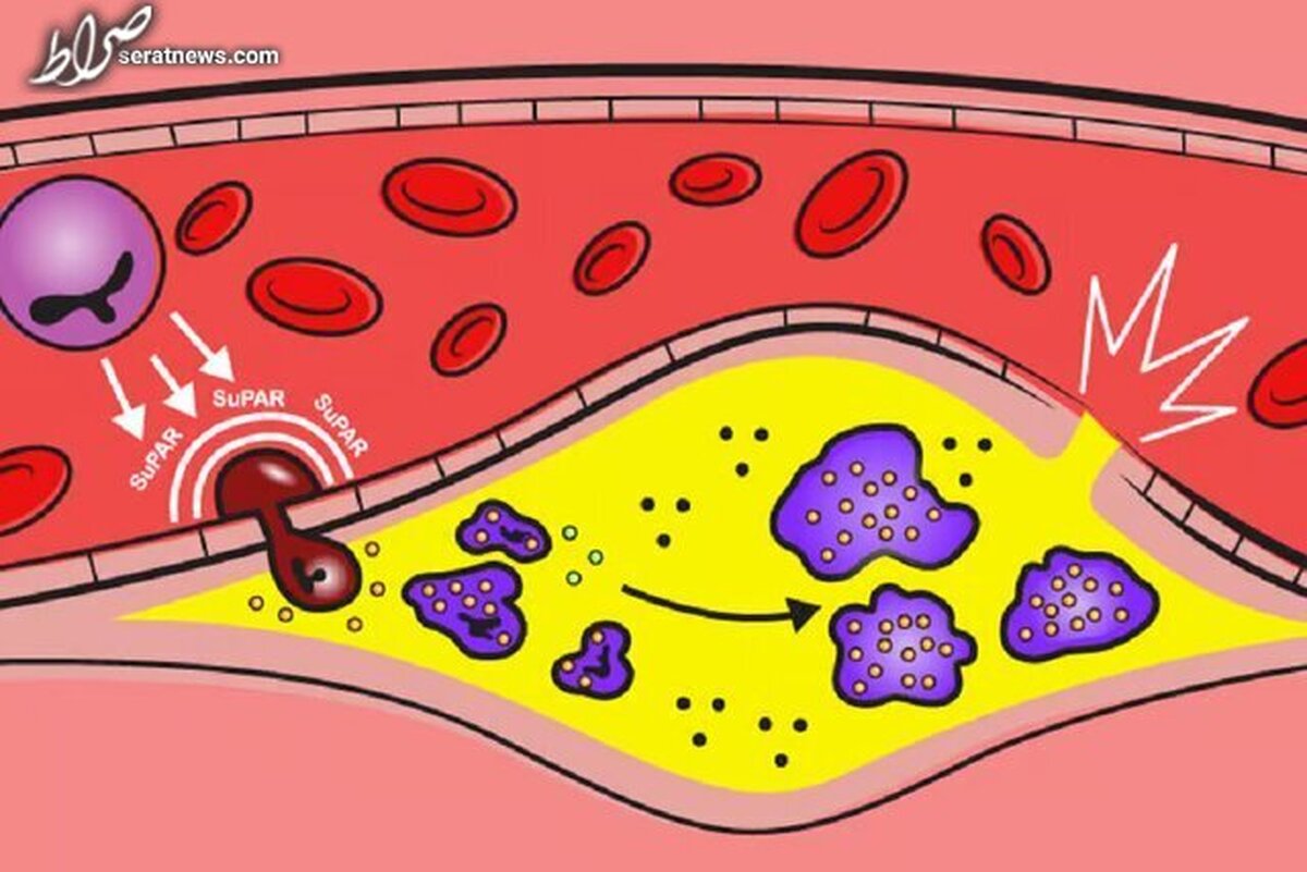 کشف پروتئینی که منجر به بیماری قلبی می‌شود
