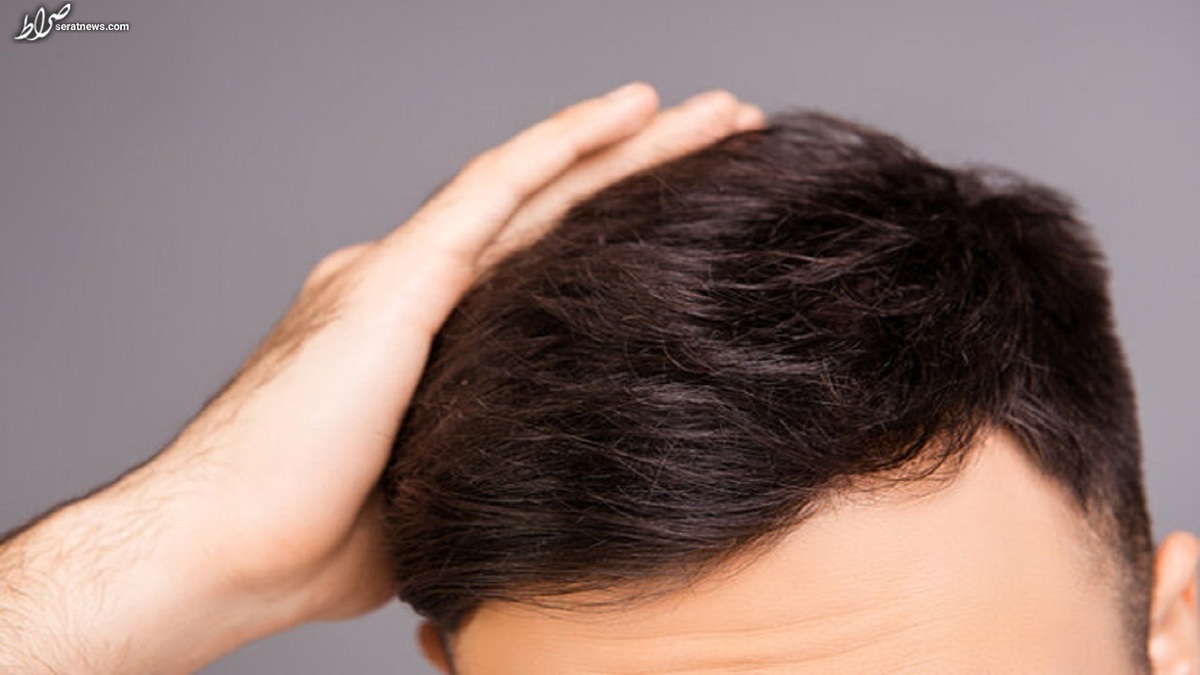 رژیم غذایی فوقالعاده برای افزایش رشد مو
