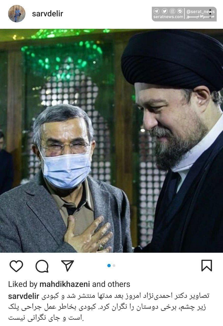 ماجرای انتشار عکسی از احمدی‌نژاد با صورت کبود و ورم‌کرده + عکس