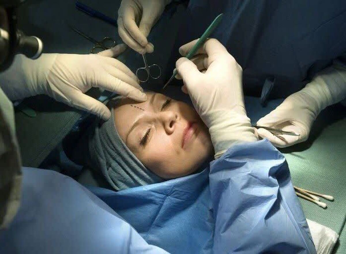 زنان ایرانی با جراحی زیبایی به دنبال مزیت‌های شغلی بیشتری هستند/ انجام ۳۲۰ هزار عمل زیبایی در ایران در سال ۲۰۲۲