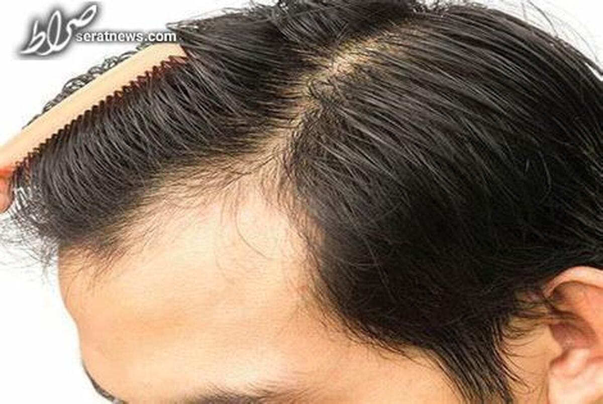 ۷ ماده غذایی برای پرپشت کردن موها بعد از ۳۰ سالگی
