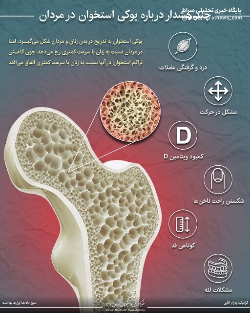 اینفوگرافیک / چند هشدار درباره پوکی استخوان در مردان