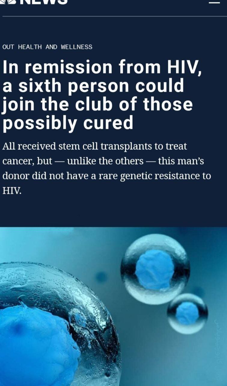 پزشکان یک فرد دیگر مبتلا به ایدز را درمان کردند