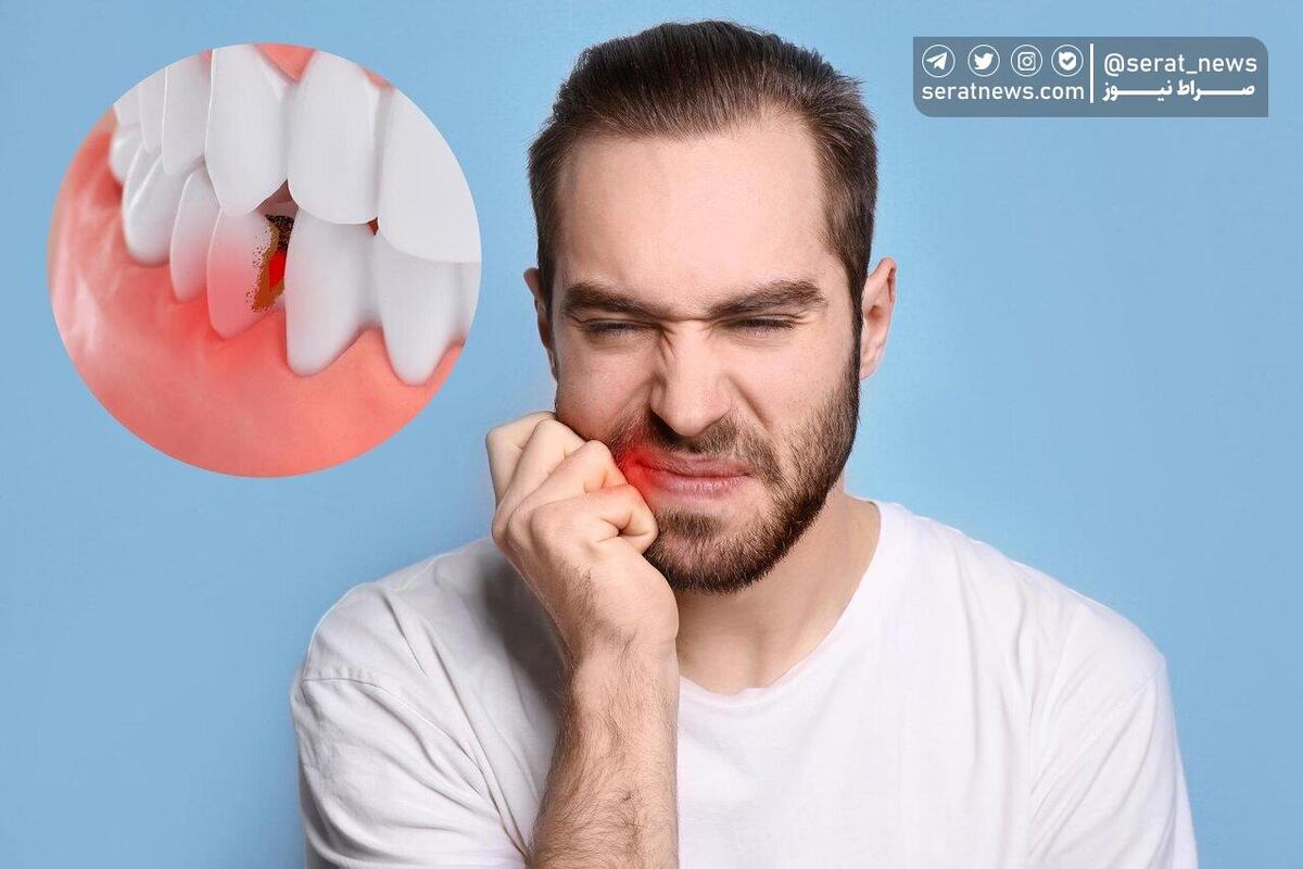 رازهای داشتن دندان سالم
