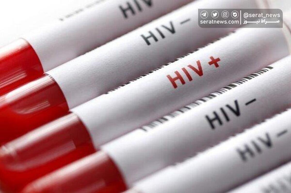 وضعیت بروز HIV در کشور