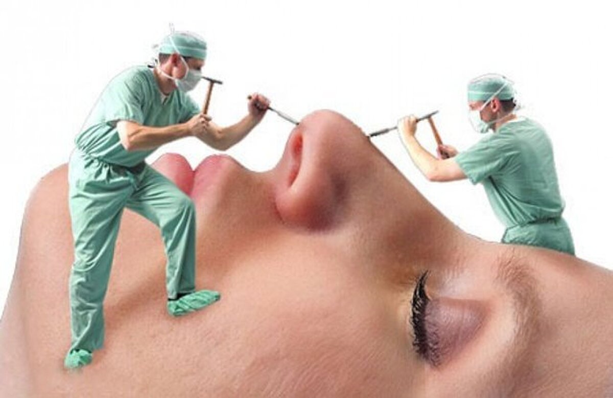 دلالی جراحیهای زیبایی در فضای مجازی