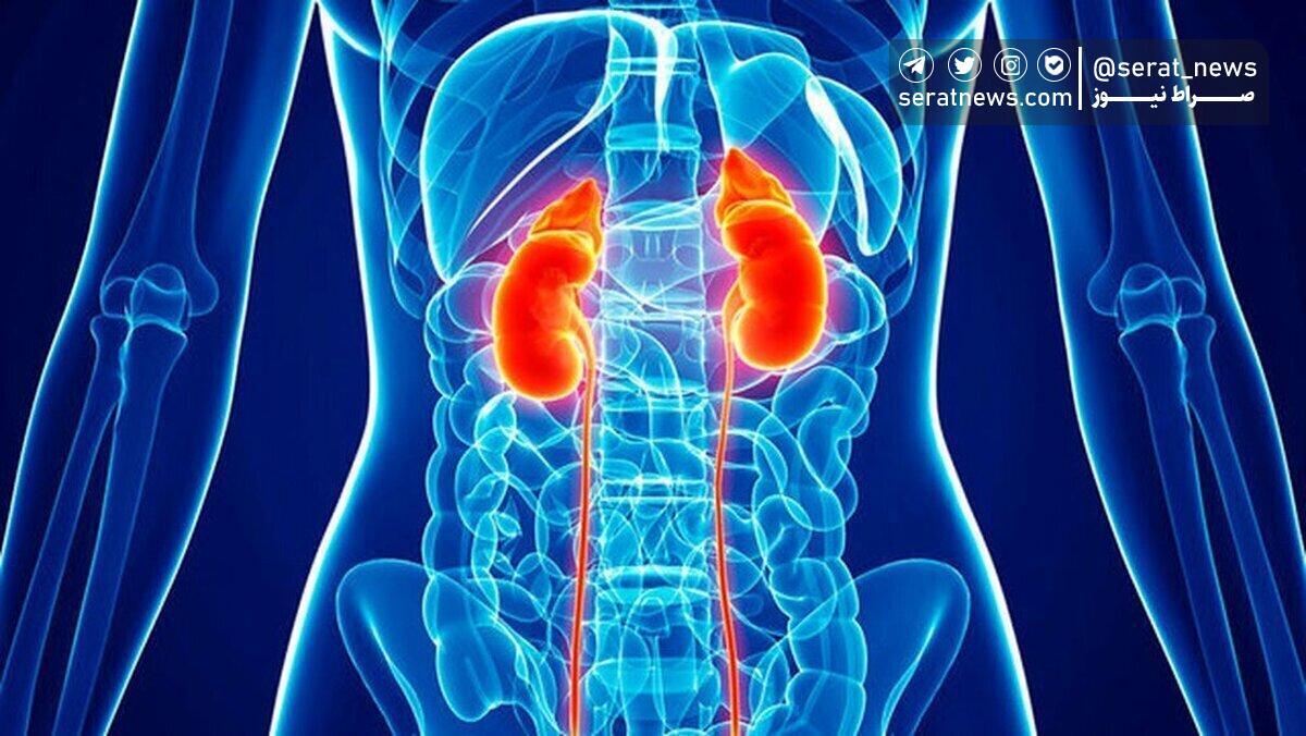 مواد غذایی مفید برای سلامت کلیه‌ها