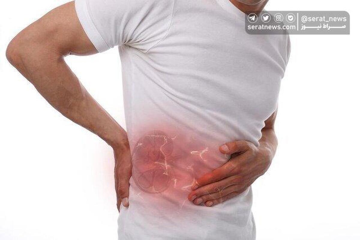 دلایل بروز سنگ کلیه چیست؟