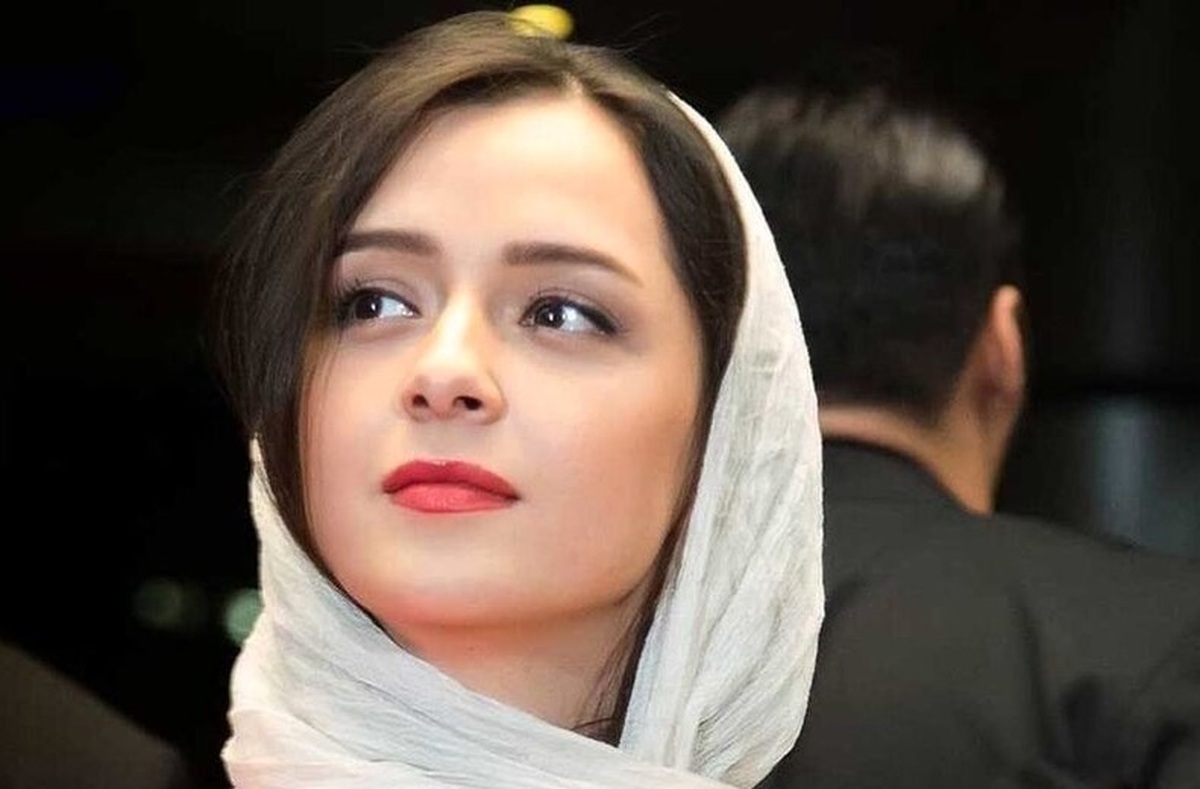 وکیل ترانه علیدوستی: موکلم از مرداد ۱۴۰۲ به سندرم Dress مبتلا شده