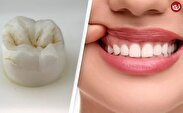 ۶ سال دیگر صبر کنید؛ دندان‌هایتان دوباره درمی‌آیند!