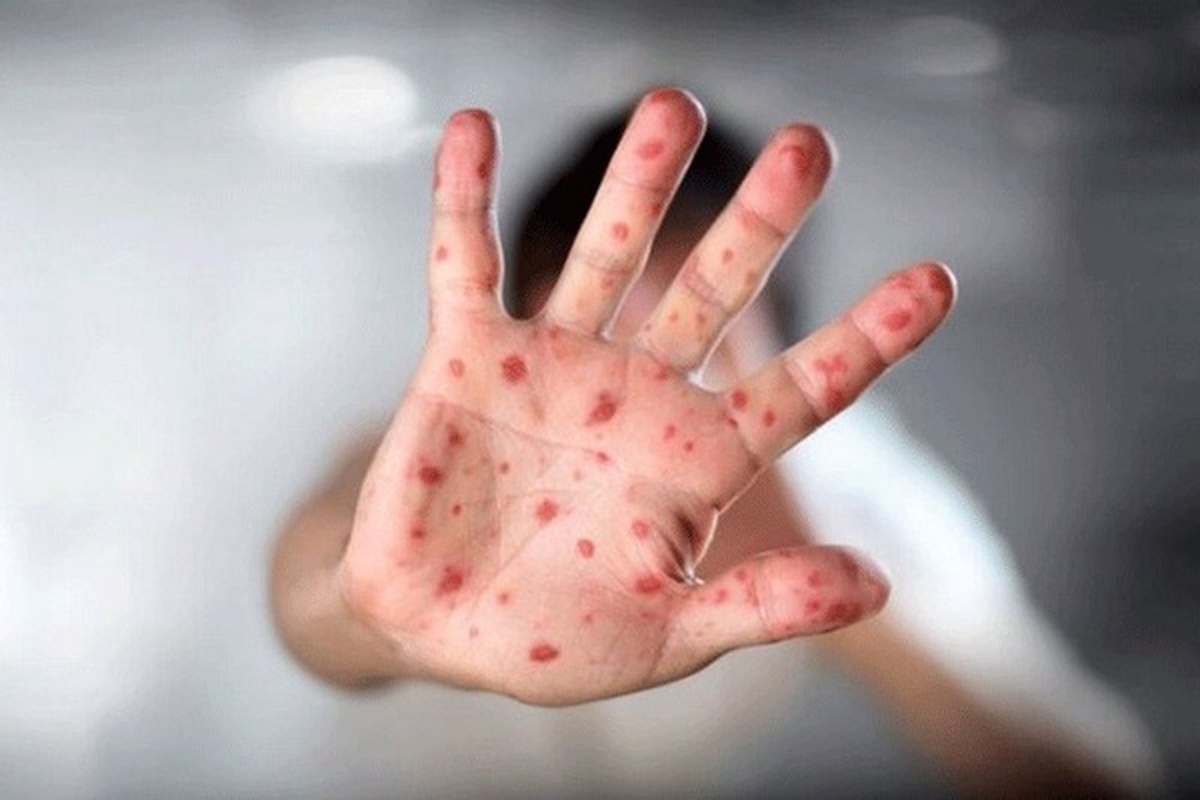 در پیادهروی اربعین از این ویروس فاصله بگیرید