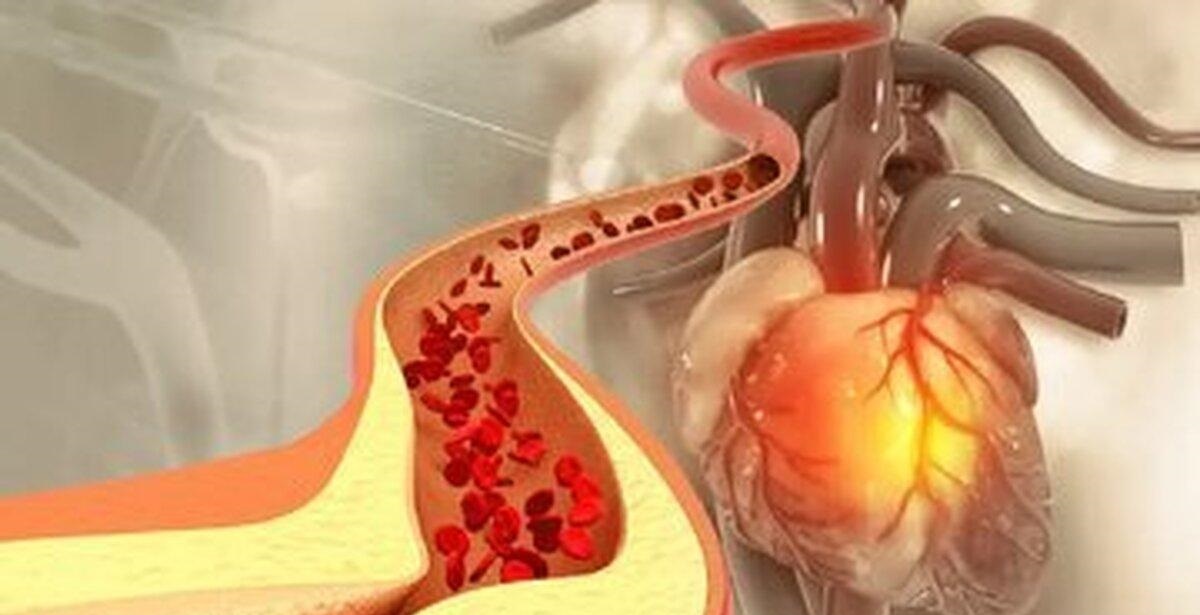این مشکل خون را بدون دارو کنترل کنید