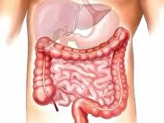 این ۵ نشانه‌ را جدی بگیرید چون روده‌تان در خطر است