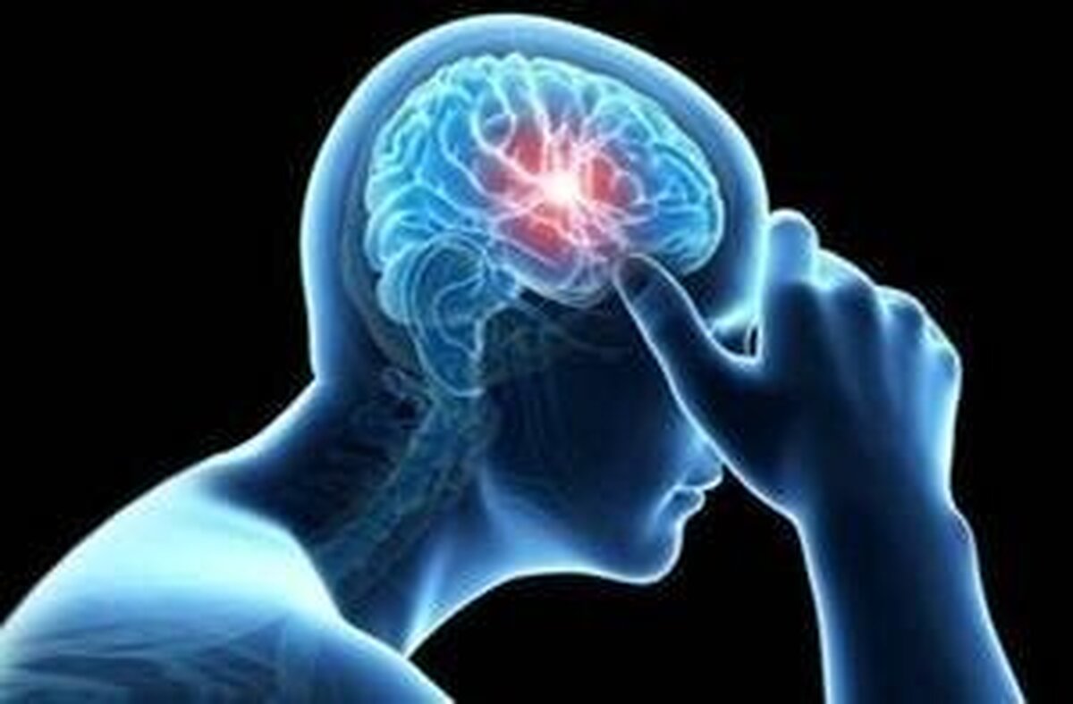 شناسایی دقیق سکته مغزی با هوش مصنوعی