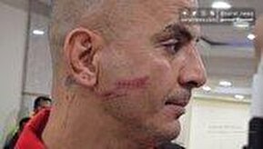 فیلم| برخورد شدید حامد لک با بازیکن ذوب آهن: شبیه اسکار فیس شدم!