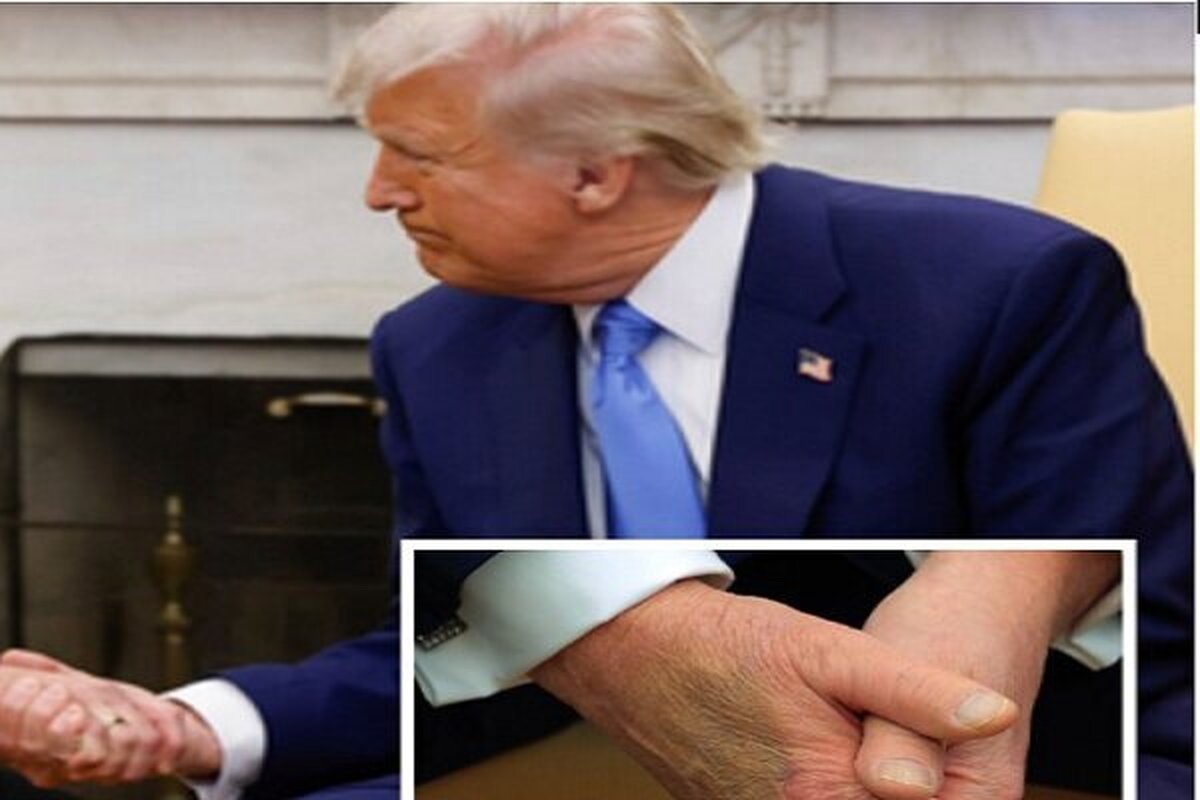 کاخ سفید از بیماری مزمن ترامپ پرده برداشت
