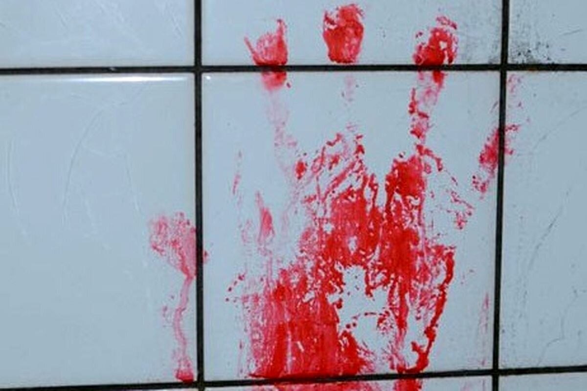 قاچاق هولناک اعضای بدن در تهران | باند تبهکار لو رفت