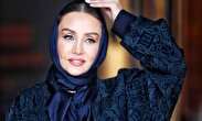 حدیث فولادوند: فقط دو بار عمل زیبایی بینی انجام دادم