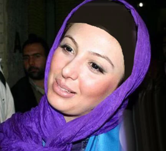 عکس | اولین عکس از چهره واقعی نیوشا ضیغمی قبل از عمل زیبایی