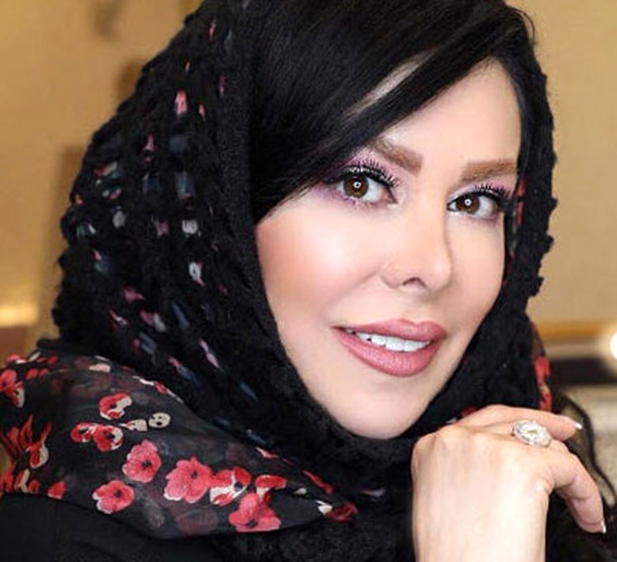 عکس| تغییر چهره‌ی فاحش و عجیب فلور نظری بعد از عمل های